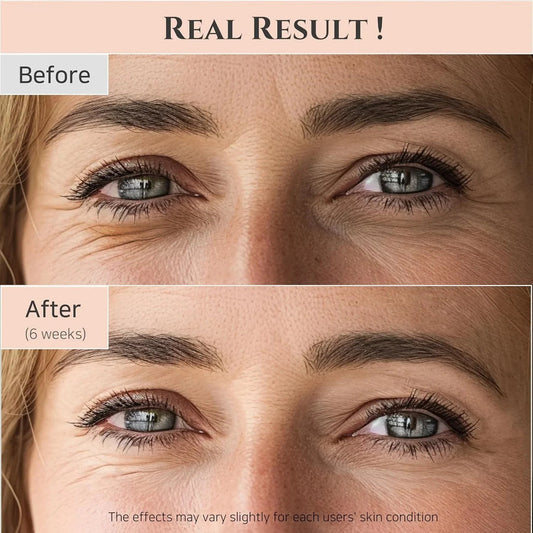 Beauty of Joseon Revive Eye Serum with Retinal Niacinamide Peptide for Face Under Eyes Wrinkles Dark Circles Moisturizer Cream Korean Skincare 30ml, 1 fl.oz * 2pack