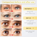 24K Gold Under Eye Patches – 60pcs for Dark Circles, Puffiness & Wrinkles Care