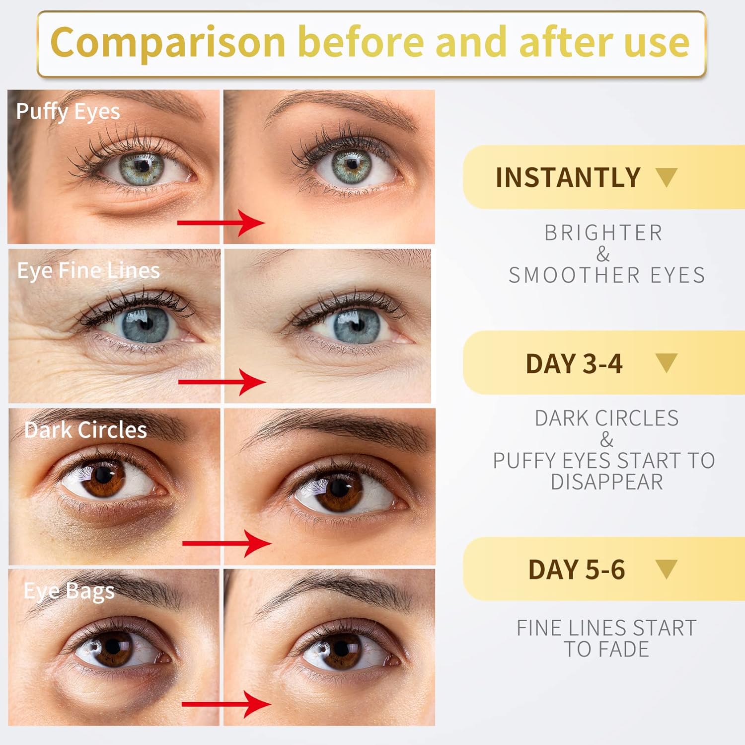 24K Gold Under Eye Patches – 60pcs for Dark Circles, Puffiness & Wrinkles Care
