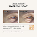 Asterwood Triple Repair Matrixyl 3000 + Argireline + Hyaluronic Acid + Vitamin C Serum for Face - Anti-Aging, Collagen Boosting, Hydrating - Fragrance-Free - 1 Fl Oz