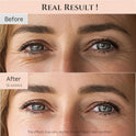 Beauty of Joseon Revive Eye Serum with Retinal Niacinamide Peptide for Face Under Eyes Wrinkles Dark Circles Moisturizer Cream Korean Skincare 30ml, 1 fl.oz * 2pack